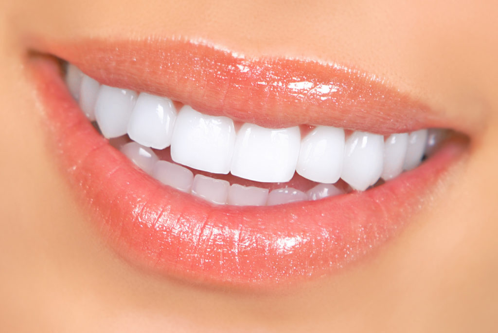 How to Keep Your Teeth White After Whitening