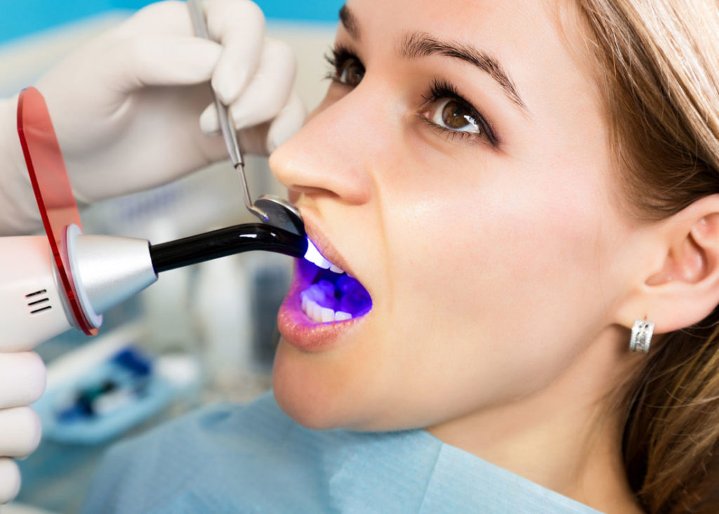 Cosmetic Benefits of Dental Bonding
